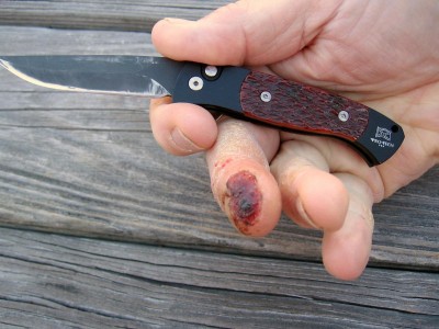 Cut Finger.JPG
