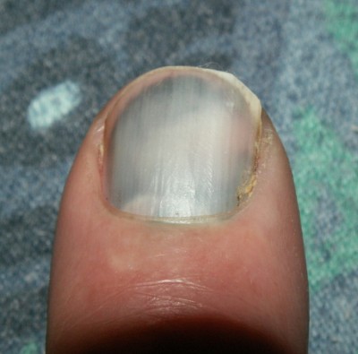 PICT0001.JPG