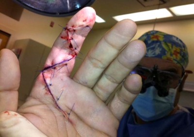 cut-finger-.jpg