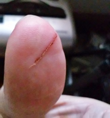Cut Thumb.jpg