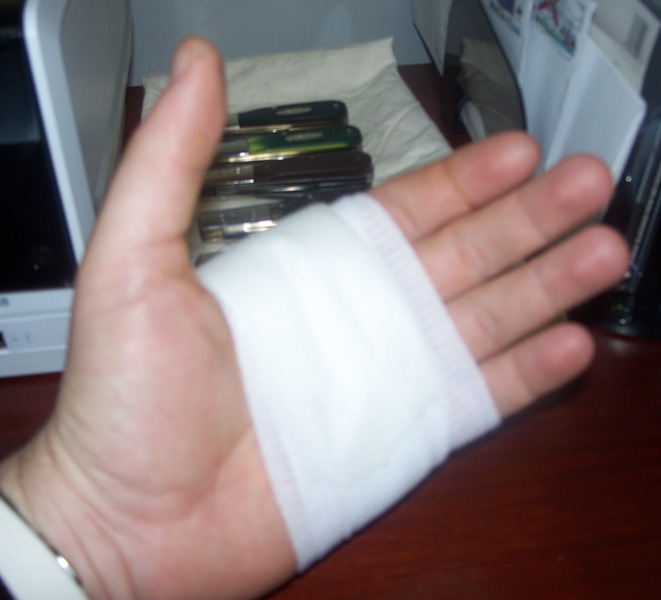 hurt 002.jpg