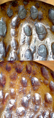 HIBBARD BONE BEFORE AND AFTER-1.png
