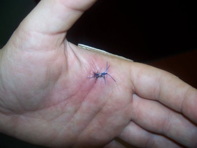 hurt 0052.jpg