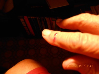 Done closed it on my finger