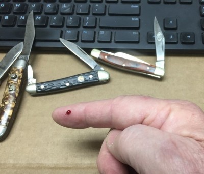 IT BIT ME.JPG