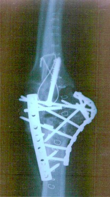 elbow 2nd. time blow up.jpg