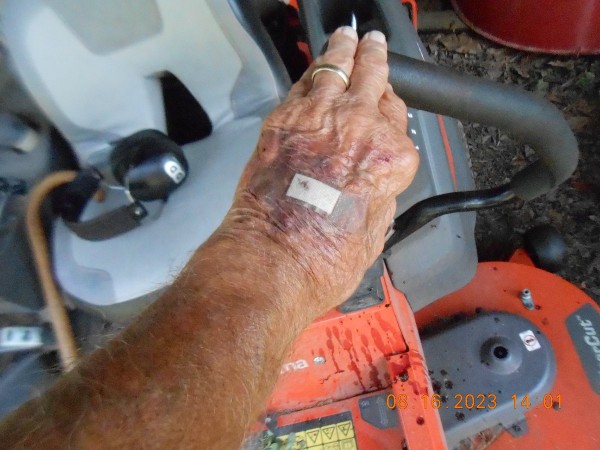 It quit bleedin' by the time I got to the house but Miss Joy put on a little bandage and sent me back to the job!